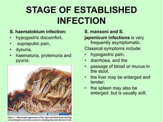 STAGE OF ESTABLISHED
INFECTION
S. haematobium infection:
• hypogastric discomfort,
• suprapubic pain,
• dysuria,
• haematuria, proteinuria and
pyuria.
S. mansoni and S.
japonicum infections is very
frequently asymptomatic.
Classical symptoms include:
• hypogastric pain,
• diarrhoea, and the
• passage of blood or mucus in
the stool.
• the liver may be enlarged and
tender;
• the spleen may also be
enlarged, but is usually soft.
 