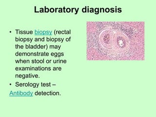 Laboratory diagnosis
• Tissue biopsy (rectal
biopsy and biopsy of
the bladder) may
demonstrate eggs
when stool or urine
examinations are
negative.
• Serology test –
Antibody detection.
 