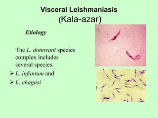 Visceral Leishmaniasis
(Kala-azar)
Etiology
The L. donovani species
complex includes
several species:
 L. infantum and
 L. chagasi
 