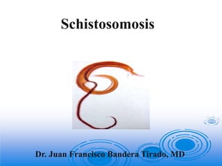 Dr. Juan Francisco Bandera Tirado, MD
Schistosomosis
 
