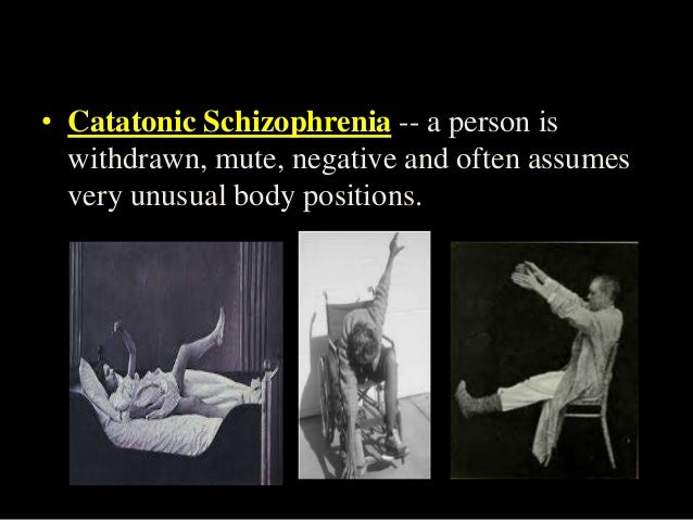 catatonic schizophrenia