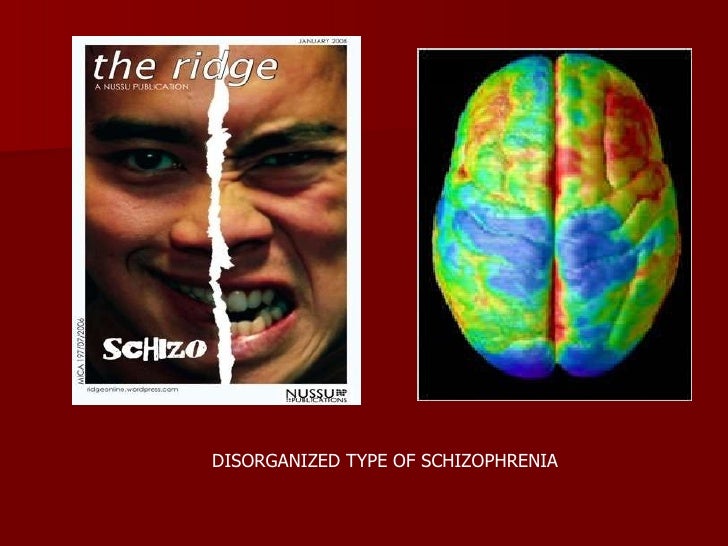 Schizophrenia