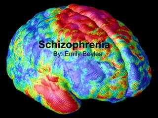 Schizophrenia
  By: Emily Boyles
 