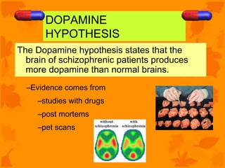 DOPAMINE
       HYPOTHESIS
The Dopamine hypothesis states that the
  brain of schizophrenic patients produces
  more dopamine than normal brains.
  –Evidence comes from
     –studies with drugs
     –post mortems
     –pet scans
 