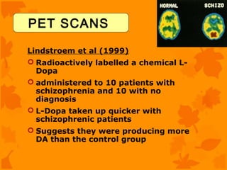 PET SCANS

Lindstroem et al (1999)
 Radioactively labelled a chemical L-
  Dopa
 administered to 10 patients with
  schizophrenia and 10 with no
  diagnosis
 L-Dopa taken up quicker with
  schizophrenic patients
 Suggests they were producing more
  DA than the control group
 