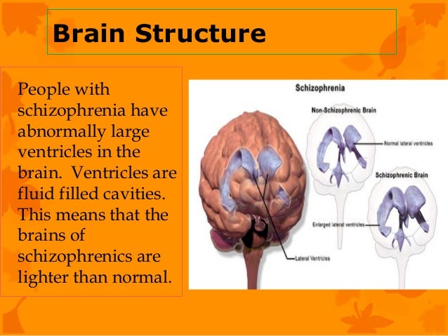 Can stress cause memory loss and confusion picture 4