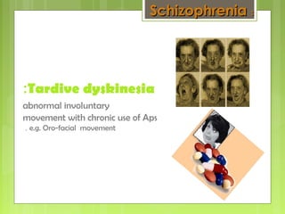 Tardive dyskinesia:
abnormal involuntary
movement with chronic use of Aps
e.g. Oro-facial movement.
SchizophreniaSchizophrenia ::
 