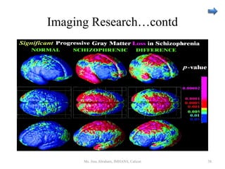 Imaging Research…contd
Ms. Jinu Abraham, IMHANS, Calicut 38
 
