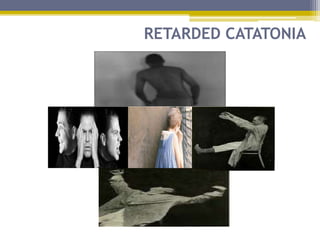 RETARDED CATATONIA
 