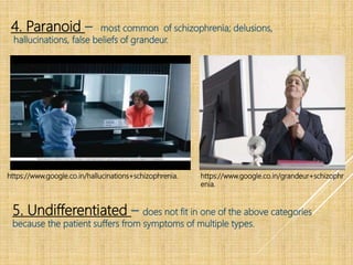 4. Paranoid – most common of schizophrenia; delusions,
hallucinations, false beliefs of grandeur.
https://www.google.co.in/grandeur+schizophr
enia.
https://www.google.co.in/hallucinations+schizophrenia.
5. Undifferentiated – does not fit in one of the above categories
because the patient suffers from symptoms of multiple types.
 