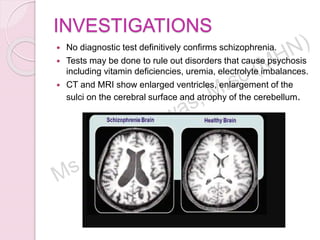 INVESTIGATIONS
 No diagnostic test definitively confirms schizophrenia.
 Tests may be done to rule out disorders that cause psychosis
including vitamin deficiencies, uremia, electrolyte imbalances.
 CT and MRI show enlarged ventricles, enlargement of the
sulci on the cerebral surface and atrophy of the cerebellum.
 