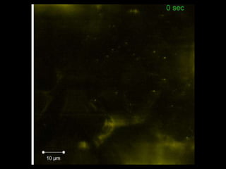 Intracellular highways in the plants:  the role of the cytoskeleton in camv infections