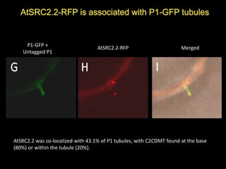 Intracellular highways in the plants:  the role of the cytoskeleton in camv infections
