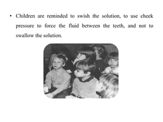 • Children are reminded to swish the solution, to use cheek
pressure to force the fluid between the teeth, and not to
swallow the solution.
 