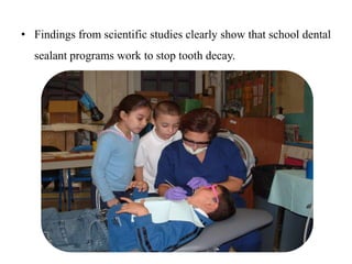 • Findings from scientific studies clearly show that school dental
sealant programs work to stop tooth decay.
 