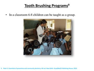 Tooth Brushing Programs9
• In a classroom 6-8 children can be taught as a group.
9. Peter S. Essentials of preventive and community dentistry. 4th ed. New Delhi: Arya(Medi) Publishing House; 2010.
 