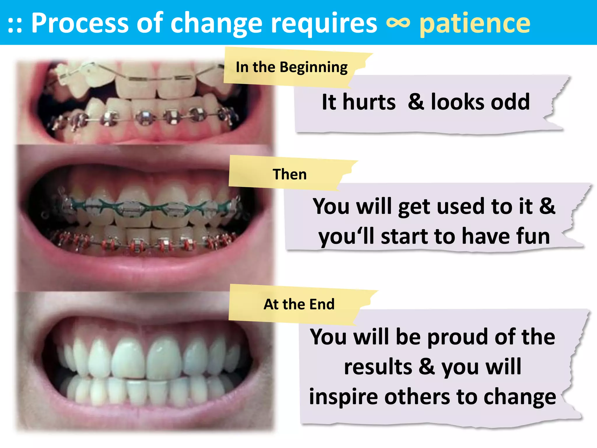 :: Process of change requires ∞ patience
                 In the Beginning

                              It hurts & looks odd

                      Then

                             You will get used to it &
                              you‘ll start to have fun

                    At the End

                             You will be proud of the
                                results & you will
                             inspire others to change
 