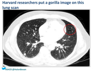 #SHCR @HelenBevan
Harvard researchers put a gorilla image on this
lung scan
 