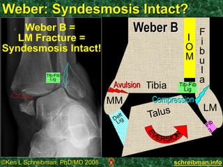 Ankle twisting injuries MSK Radiology | PPSX