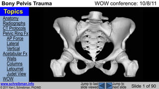 Anatomy
Radiographs
CT Protocols
Pelvic Ring Fx
AP Force
Lateral
Vertical
Acetabular Fx
Walls
Columns
Letournel
Judet View
WOW
© 2011 Ken L Schreibman, PhD/MD
www.schreibman.info
Bony Pelvis Trauma WOW conference: 10/8/11
Slide 1 of 90
Jump to
next slide
Jump to last
slide viewed
Topics
 