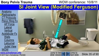 Bony Pelvis Trauma MSK Radiology Lecture | PPSX