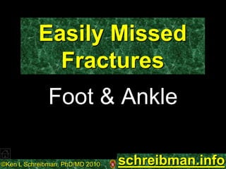 ©Ken L Schreibman, PhD/MD 2010 schreibman.info
Easily Missed
Fractures
Foot & Ankle
schreibman.info
 