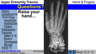Upper Extremity Trauma MSK Radiology Lecture | PPSX