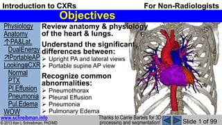 © 2013 Ken L Schreibman, PhD/MD
www.schreibman.info
Slide 1 of 99
Introduction to CXRs For Non-Radiologists
Physiology
Anatomy
PA&Lat.
DualEnergy
PortableAP
Looking@CXR
Normal
PTX
Pl.Effusion
Pneumonia
Pul.Edema
WOW
Objectives
Review anatomy & physiology
of the heart & lungs.
Understand the significant
differences between:
 Upright PA and lateral views
 Portable supine AP view
Recognize common
abnormalities:
 Pneumothorax
 Pleural Effusion
 Pneumonia
 Pulmonary Edema
Thanks to Carrie Bartels for 3D
processing and segmentation!
 