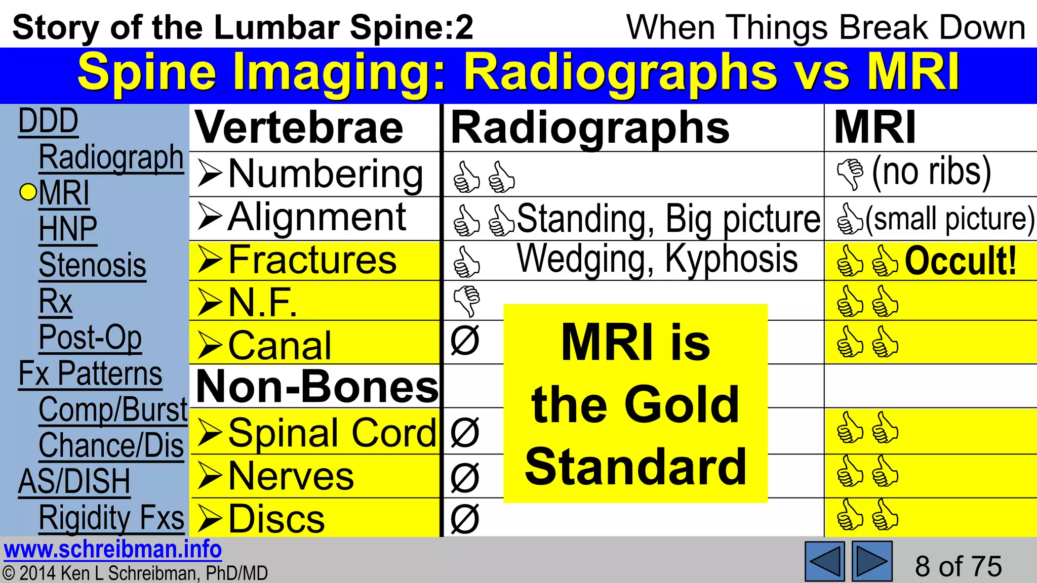 Story of the Lumbar Spine 2 When Things Break Down | PPSX