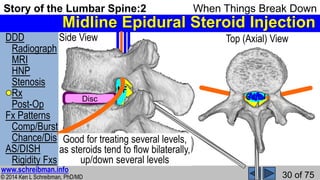 Hnp Injection Story of the Lumbar Spine 2 When Things Break Down | PPSX