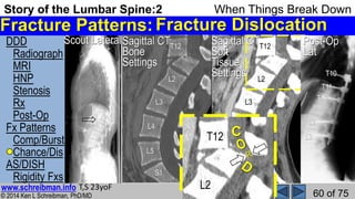 Story of the Lumbar Spine 2 When Things Break Down | PPSX