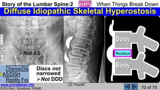 Story of the Lumbar Spine 2 When Things Break Down | PPSX