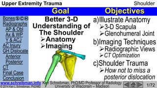 Bones
Radiographs
AP & Obl
Ax & WP
Y & ACJ
AC Injury
GH Dislocate
Anterior
Posterior
CT
Final Case
Conclusion
© 2014 Ken L Schreibman, PhD/MD
www.schreibman.info
Upper Extremity Trauma Shoulder
1/72
S C H
Goal Objectives
Better 3-D
Understanding of
The Shoulder
Anatomy
Imaging
a)Illustrate Anatomy
3-D Scapula
Glenohumeral Joint
b)Imaging Techniques
Radiographic Views
CT Optimization
c)Shoulder Trauma
How not to miss a
posterior dislocation
www.schreibman.info Ken Schreibman, PhD/MD Professor of Radiology
University of Wisconsin – Madison
 