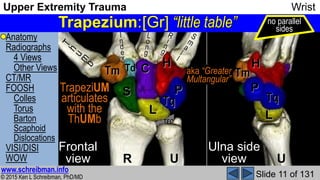 Greater And Lesser Multangular Upper Extremity Trauma Wrist complete MSK Radiology Lecture | PPSX