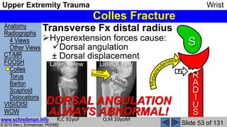 Upper Extremity Trauma Wrist complete MSK Radiology Lecture | PPSX