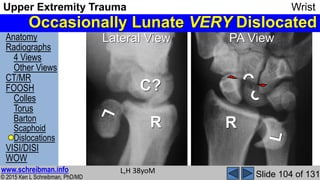 Upper Extremity Trauma Wrist complete MSK Radiology Lecture | PPSX
