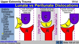 Upper Extremity Trauma Wrist complete MSK Radiology Lecture | PPSX