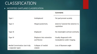 SCH- supracondylar humerus fracture in childrens | PPTX
