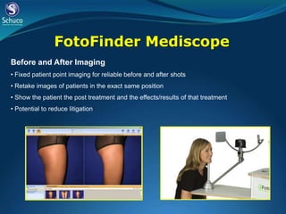 FotoFinder Mediscope
Before and After Imaging
• Fixed patient point imaging for reliable before and after shots
• Retake images of patients in the exact same position
• Show the patient the post treatment and the effects/results of that treatment
• Potential to reduce litigation
 