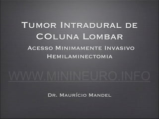 Tumor Intradural de
   COluna Lombar
  Acesso Minimamente Invasivo
       Hemilaminectomia

WWW.MININEURO.INFO
       Dr. Maurício Mandel
 