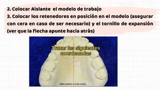 2. Colocar Aislante el modelo de trabajo
3. Colocar los retenedores en posición en el modelo (asegurar
con cera en caso de ser necesario) y el tornillo de expansión
(ver que la flecha apunte hacia atrás)
 