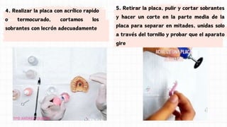 4. Realizar la placa con acrílico rapido
o termocurado, cortamos los
sobrantes con lecrón adecuadamente
5. Retirar la placa, pulir y cortar sobrantes
y hacer un corte en la parte media de la
placa para separar en mitades, unidas solo
a través del tornillo y probar que el aparato
gire
 