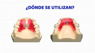 ¿DÓNDE SE UTILIZAN?
 