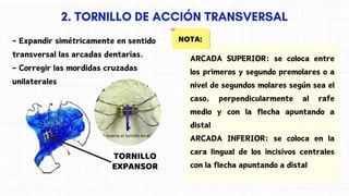 NOTA:
- Expandir simétricamente en sentido
transversal las arcadas dentarias.
- Corregir las mordidas cruzadas
unilaterales
TORNILLO
EXPANSOR
ARCADA SUPERIOR: se coloca entre
los primeros y segundo premolares o a
nivel de segundos molares según sea el
caso, perpendicularmente al rafe
medio y con la flecha apuntando a
distal
ARCADA INFERIOR: se coloca en la
cara lingual de los incisivos centrales
con la flecha apuntando a distal
 