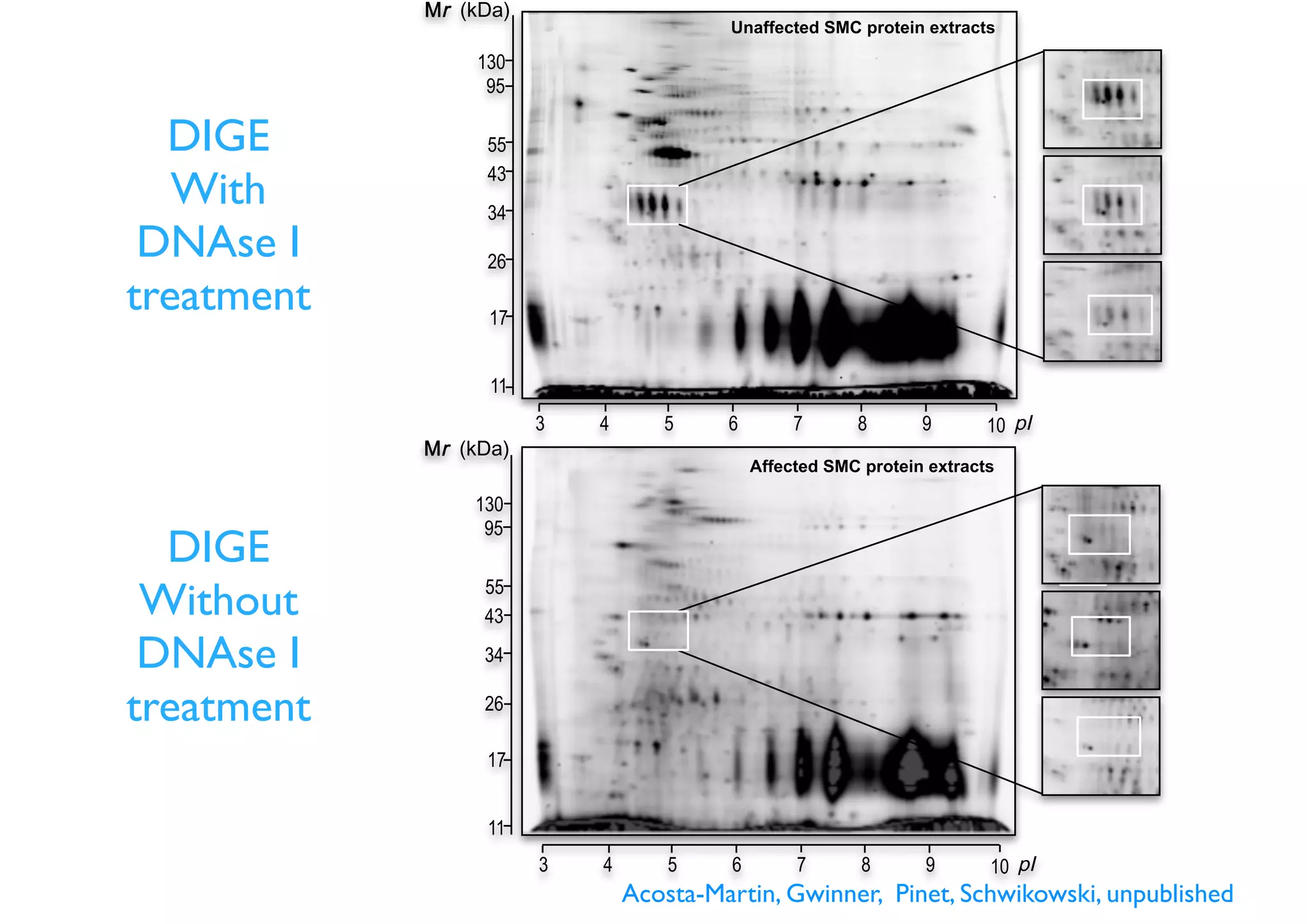 Affected SMC protein extracts
3 104 5 6 7 8 9
43
34
26
55
95
130
17
11
Unaffected SMC protein extracts
43
34
26
55
95
130
17
11
3 104 5 6 7 8 9
DIGE
Without
DNAse I
treatment
DIGE
With
DNAse I
treatment
Acosta-Martin, Gwinner, Pinet, Schwikowski, unpublished
 