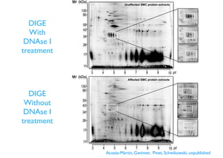 Affected SMC protein extracts
3 104 5 6 7 8 9
43
34
26
55
95
130
17
11
Unaffected SMC protein extracts
43
34
26
55
95
130
17
11
3 104 5 6 7 8 9
DIGE
Without
DNAse I
treatment
DIGE
With
DNAse I
treatment
Acosta-Martin, Gwinner, Pinet, Schwikowski, unpublished
 