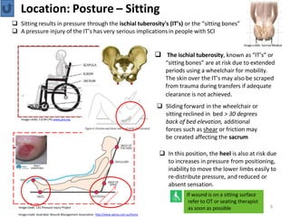 SCI Pressure Injury Toolkit L Katte pptx sci-pressure-injury-toolkit-l-katte-pptx