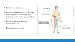 • Lateral cord syndrome.
• Ipsilateral loss of fine touch, vibratory
sense & position sense along with
ipsilateral upper motor neuron deficits.
• Pain & temperature loss on
contralateral side.
• Penetrating injuries(stab)
 