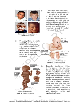 D
EPED
C
O
PY
289
(a)	 “Cri du chat” is caused by the
deletion of part of the short arm
of chromosome 5. “Cri du chat”
is French, and the condition
is so named because affected
babies make high-pitched cries
that sound like a cat. Affected
individuals have wide-set eyes,
a small head and jaw, are
moderately to severely mentally
retarded, and very short.
Source: player.mashpedia.com
Figure 11. Cri du chat
(b)	 Down’s syndrome is usually
caused by an extra copy
of chromosome 21(trisomy
21). Characteristics include
decreased muscle tone,
stockier build, asymmetrical
skull, slanting eyes and
mild to moderate mental
retardation.
Source: www.healthtap.com
Figure 12. Down’s Syndrome
(c)	 Edwards syndrome, which
is the second most common
trisomy after Down’s syndrome,
is a trisomy of chromosome 18.
Symptoms include mental and
motor retardation and numerous
congenital anomalies causing
serious health problems. About
99% die in infancy. However,
those who live past their first
birthday, usually are quite
healthy thereafter. They have a
characteristic hand appearance
with clenched hands and
overlapping fingers.
Source: healthtap.com
Figure 13. Edward Syndrome
flattened
nose and
face, upward
slanting eyes
widely seperated
first and second
toes and
increased skin
creases
single palmer
crease, short
fifth finger that
curves inward
small mouth,
small jaw,
short neck
shield chest,
or short and
prominent
sternum;
and wide-set
nipples
occiput, or back
part of the skull, is
prominent
dysplastic, or
malformed ears
clenched hands
with overlapping
fingers
flexed big toe;
prominent heels
All rights reserved. No part of this material may be reproduced or transmitted in any form or by any means -
electronic or mechanical including photocopying – without written permission from the DepEd Central Office. First Edition, 2015.
 