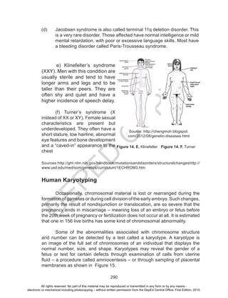 D
EPED
C
O
PY
290
e) Klinefelter’s syndrome
(XXY). Men with this condition are
usually sterile and tend to have
longer arms and legs and to be
taller than their peers. They are
often shy and quiet and have a
higher incidence of speech delay.
(f) Turner’s syndrome (X
instead of XX or XY). Female sexual
characteristics are present but
underdeveloped. They often have a
short stature, low hairline, abnormal
eye features and bone development
and a “caved-in” appearance to the
chest
Figure 14. F. TurnerFigure 14. E. Klinefelter
Source: http://chengmoh.blogspot.
com/2012/08/genetic-diseases.html
Sources:http://ghr.nlm.nih.gov/handbook/mutationsanddisorders/structuralchangeshttp://
www.usd.edu/med/som/genetics/curriculum/1ECHROM3.htm
Human Karyotyping
	 Occasionally, chromosomal material is lost or rearranged during the
formation of gametes or during cell division of the early embryo. Such changes,
primarily the result of nondisjunction or translocation, are so severe that the
pregnancy ends in miscarriage – meaning loss of an embryo or fetus before
the 20th week of pregnancy or fertilization does not occur at all. It is estimated
that one in 156 live births has some kind of chromosomal abnormality.
	 Some of the abnormalities associated with chromosome structure
and number can be detected by a test called a karyotype. A karyotype is
an image of the full set of chromosomes of an individual that displays the
normal number, size, and shape. Karyotypes may reveal the gender of a
fetus or test for certain defects through examination of cells from uterine
fluid – a procedure called amniocentesis – or through sampling of placental
membranes as shown in Figure 15.
(d) 	 Jacobsen syndrome is also called terminal 11q deletion disorder. This
is a very rare disorder. Those affected have normal intelligence or mild
mental retardation, with poor or excessive language skills. Most have
a bleeding disorder called Paris-Trousseau syndrome.
All rights reserved. No part of this material may be reproduced or transmitted in any form or by any means -
electronic or mechanical including photocopying – without written permission from the DepEd Central Office. First Edition, 2015.
 